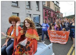 لماذا يوجد الكثير من حمر الشعر في اسكتلندا؟