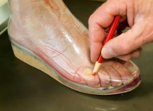 كيفية اختيار الأحذية لإبهام القدم الأروح