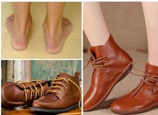 أحذية تقويم العظام للنساء المصابات بإبهام القدم الأروح: توصيات للاختيار والشراء