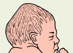 الرضيع: عدم تناسق شكل الجمجمة وكيفية التعامل معه